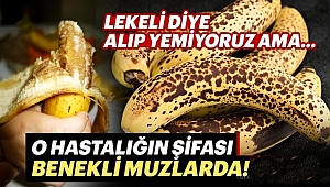Benekli Muz Şifa Kaynağı