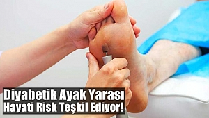Diyabetik Ayak Yarası Hayati Risk Teşkil Ediyor!