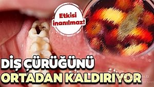 Dişlerinizi Böyle Koruyabilirsiniz