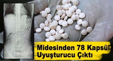 Midesinden 78 Kapsül Uyuşturucu Çıktı