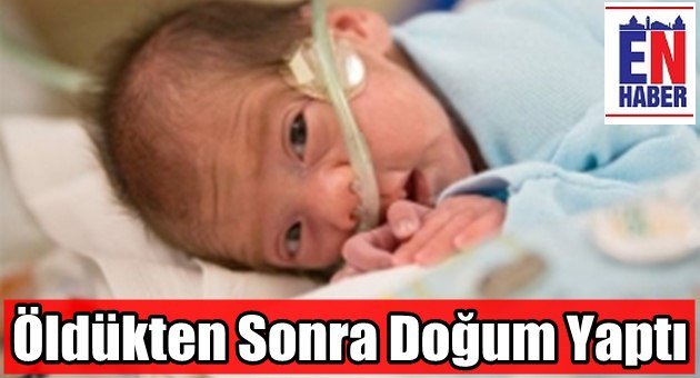 Bebeği İçin 54 Gün Direndi