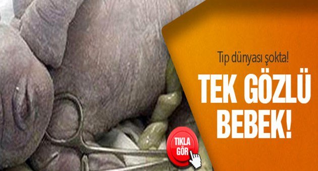 Dünya Tek Gözlü bebekle Tanıştı!