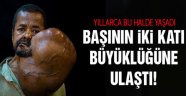 30 Yıl Böyle Yaşadı!