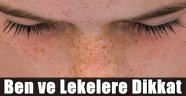 Ben ve Lekelere Dikkat