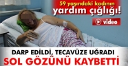 Canice Saldırıda Gözünü Kaybetti